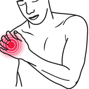 CBD Oil for Arthritis Treatment